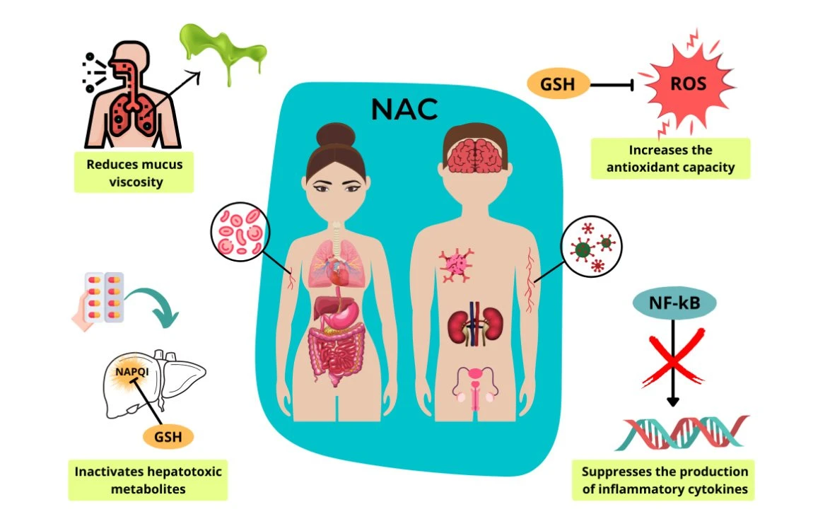 NAC